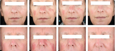 Beach commercial thumbnail